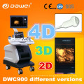 hospital usó escáner de ultrasonido 3D 4D y precio Doppler color